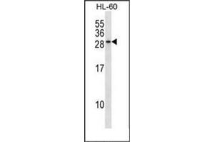 Western Blotting (WB) image for anti-RAB15, Member RAS Onocogene Family (RAB15) (AA 104-133), (Middle Region) antibody (ABIN954407)