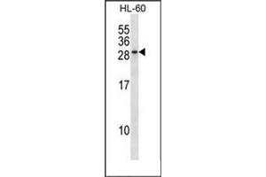 Western blot analysis of RAB15 Antibody (Center) in HL-60 cell line lysates (35ug/lane). (RAB15 抗体  (Middle Region))