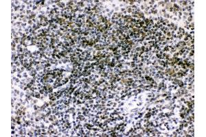 Anti- RAG2 Picoband antibody, IHC(P) IHC(P): Mouse Spleen Tissue (RAG2 抗体  (C-Term))