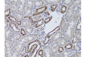 Immunohistochemistry of paraffin-embedded mouse kidney using ITGAV antibody. (CD51 抗体)