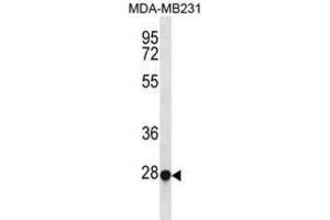 Western Blotting (WB) image for anti-Transcription Factor EC (TFEC) antibody (ABIN3000962) (TFEC 抗体)