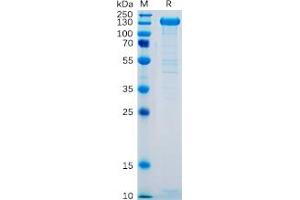 Human SELP Protein, hFc Tag on SDS-PAGE under reducing condition. (P-Selectin Protein (Fc Tag))