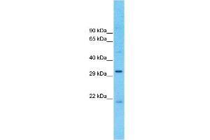 Host:  Rabbit  Target Name:  MCUR1  Sample Type:  OVCAR-3 Cell lysates  Antibody Dilution:  1.