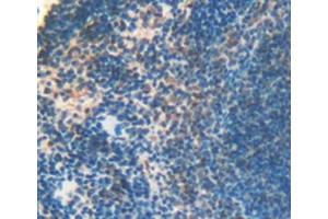Immunohistochemistry (IHC) image for anti-Lysyl Oxidase-Like 3 (LOXL3) (AA 509-712) antibody (ABIN7439201)