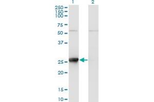 Western Blot analysis of TK1 expression in transfected 293T cell line by TK1 monoclonal antibody (M11), clone 2A2. (TK1 抗体  (AA 1-234))