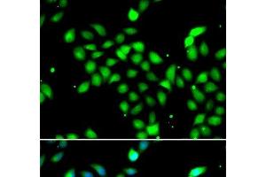 Immunofluorescence analysis of A549 cells using METTL13 Polyclonal Antibody (METTL13 抗体)