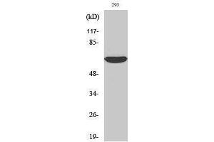 Western Blotting (WB) image for anti-Interleukin-1 Receptor-Associated Kinase 2 (IRAK2) (Internal Region) antibody (ABIN3185223)