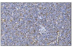 IHC analysis of MERTK using anti-MERTK antibody (ABIN7600623). (MERTK 抗体  (AA 21-489))