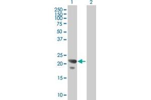 Western Blot analysis of COPS8 expression in transfected 293T cell line by COPS8 MaxPab polyclonal antibody. (COPS8 抗体  (AA 1-209))