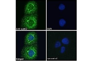 ABIN185361 Immunofluorescence analysis of paraformaldehyde fixed A431 cells, permeabilized with 0. (Lipin 2 抗体  (C-Term))