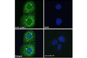 ABIN185361 Immunofluorescence analysis of paraformaldehyde fixed A431 cells, permeabilized with 0. (Lipin 2 抗体  (C-Term))