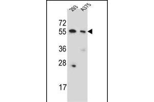 CPNE8 Antibody (N-term) (ABIN651529 and ABIN2840280) western blot analysis in 293, cell line lysates (35 μg/lane). (CPNE8 抗体  (N-Term))