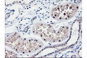 Immunohistochemical staining of paraffin-embedded Human Kidney tissue using anti-NUBPL mouse monoclonal antibody. (NUBPL 抗体  (AA 1-250))