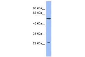 Image no. 1 for anti-Poly(A) Binding Protein, Cytoplasmic 1-Like 2A (PABPC1L2A) (C-Term) antibody (ABIN6742962) (PABPC1L2A 抗体  (C-Term))