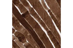 Immunohistochemical staining (Formalin-fixed paraffin-embedded sections) of human skeletal muscle with JPH1 polyclonal antibody  shows strong cytoplasmic positivity in myocytes. (Junctophilin 1 抗体  (AA 528-629))