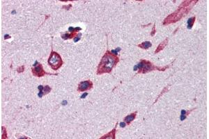 Human Brain, Cortex (formalin-fixed, paraffin-embedded) stained with CBLN4 antibody ABIN462251 followed by biotinylated goat anti-rabbit IgG secondary antibody ABIN481713, alkaline phosphatase-streptavidin and chromogen. (CBLN4 抗体  (AA 125-174))