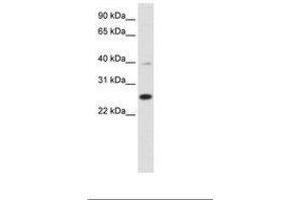 Image no. 1 for anti-YY1 Associated Factor 2 (YAF2) (C-Term) antibody (ABIN6736123) (YAF2 抗体  (C-Term))