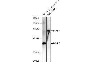 Western blot analysis of extracts of various cell lines, using MMP7 antibody (ABIN7268425 ) at 1:1000 dilution. (MMP7 抗体)