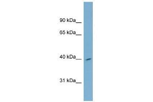 H2AFY2 antibody used at 1 ug/ml to detect target protein. (H2AFY2 抗体  (Middle Region))