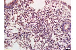 Formalin-fixed and paraffin embedded human endometrium labeled with Rabbit Anti-Oxytocin R Polyclonal Antibody, Unconjugated  at 1:200 followed by conjugation to the secondary antibody and DAB staining (Oxytocin Receptor 抗体  (AA 325-388))