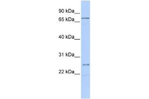 WB Suggested Anti-GALNT14 Antibody Titration:  0. (GALNT14 抗体  (Middle Region))