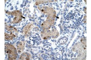 ZNF258 antibody was used for immunohistochemistry at a concentration of 4-8 ug/ml to stain Epithelial cells of renal tubule (arrows) in Human Kidney. (ZMYM6 抗体  (Middle Region))