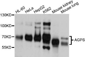 Western blot analysis of extracts of various cells, using AGPS antibody. (AGPS 抗体)