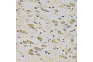 Immunohistochemistry of paraffin-embedded rat brain using RPS27 Antibody (ABIN5974067) at dilution of 1/100 (40x lens). (RPS27 抗体)