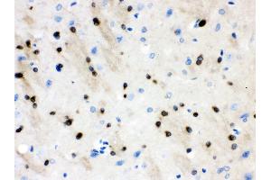 nti- Stathmin 1 Picoband antibody, IHC(P) IHC(P): Rat Brain Tissue (Stathmin 1 抗体  (N-Term))