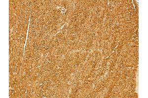 Myoferlin Antibody at 1/100 staining Mouse heart tissue by IHC-P. (Myoferlin 抗体  (Internal Region))