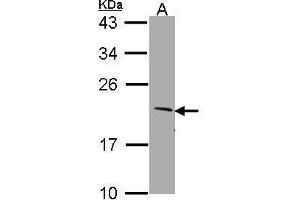WB Image Sample (30 ug of whole cell lysate) A: Molt-4 , 12% SDS PAGE SERTAD1 antibody antibody diluted at 1:1000 (SERTAD1 抗体  (N-Term))