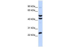 Western Blot showing ZNF200 antibody used at a concentration of 1-2 ug/ml to detect its target protein. (ZNF200 抗体  (Middle Region))