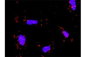 Proximity Ligation Analysis of protein-protein interactions between SUFU and GLI1. (SUFUH 抗体  (AA 1-484))