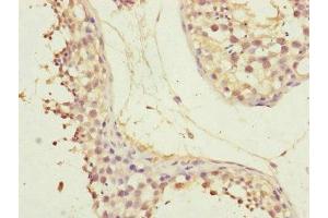 Immunohistochemistry of paraffin-embedded human testis tissue using ABIN7147423 at dilution of 1:100 (CEP72 抗体  (AA 200-460))