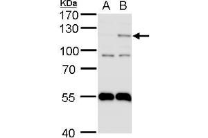 WB Image HIF2 alpha antibody detects HIF2 alpha protein by western blot analysis. (EPAS1 抗体)