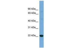 Image no. 1 for anti-Interleukin 17D (IL17D) (N-Term) antibody (ABIN6745212) (IL17D 抗体  (N-Term))