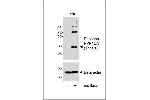 Western blot analysis of lysates from Hela cell line, untreated or treated with paclitaxel, 100nM, 20hrs, using Phospho-P1CA (Thr320) Antibody (uer) or Beta-actin (lower). (PPP1CA 抗体  (pThr320))