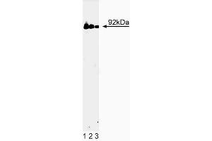 Western blot analysis of Stat3 on a A431 cell lysate (Human epithelial carcinoma, ATCC CRL-1555). (STAT3 抗体  (AA 1-175))