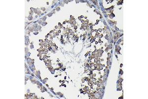 Immunohistochemistry of paraffin-embedded mouse liver using Ferritin Heavy Chain Rabbit pAb (ABIN3021538, ABIN3021539, ABIN3021540 and ABIN6215218) at dilution of 1:100 (40x lens). (FTH1 抗体  (AA 1-183))