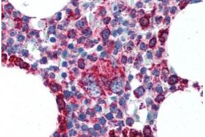 Human Bone Marrow (formalin-fixed, paraffin-embedded) stained with CYCS antibody ABIN305748 at 5 ug/ml followed by biotinylated anti-mouse IgG secondary antibody ABIN481714, alkaline phosphatase-streptavidin and chromogen. (Cytochrome C 抗体  (AA 1-80))