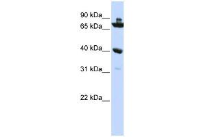 WB Suggested Anti-C7orf31 Antibody Titration: 0. (C7orf31 抗体  (N-Term))
