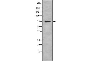 Western blot analysis SphK2 using 293 whole cell lysates (SPHK2 抗体  (N-Term))
