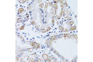 Immunohistochemistry of paraffin-embedded human stomach using DNAJC19 antibody. (DNAJC19 抗体)