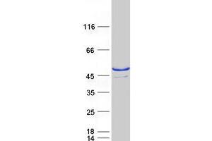 Western Blotting (WB) image for Sulfotransferase Family, Cytosolic, 2B, Member 1 (SULT2B1) (Transcript Variant 2) protein (Myc-DYKDDDDK Tag) (ABIN2732970)