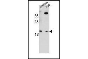 Western blot analysis of RNF185 Antibody  in Mouse kidney tissue and K562 cell line lysates (35ug/lane). (RNF185 抗体  (Middle Region))