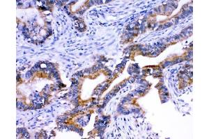 IHC analysis of Stanniocalcin 1/STC/STC1 using anti-Stanniocalcin 1/STC/STC1 antibody (ABIN7601378).