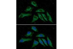 ICC/IF analysis of PPM1F in HeLa cells line, stained with DAPI (Blue) for nucleus staining and monoclonal anti-human PPM1F antibody (1:100) with goat anti-mouse IgG-Alexa fluor 488 conjugate (Green). (PPM1F 抗体  (AA 1-454))