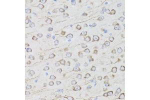 Immunohistochemistry of paraffin-embedded mouse brain using MIP antibody at dilution of 1:100 (x40 lens). (MIP 抗体)