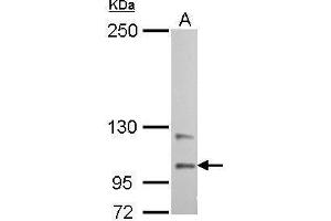 WB Image Autotaxin antibody detects ENPP2 protein by Western blot analysis. (ENPP2 抗体  (C-Term))