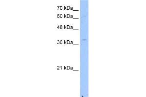 WB Suggested Anti-NSDHL Antibody Titration:  2. (NSDHL 抗体  (Middle Region))